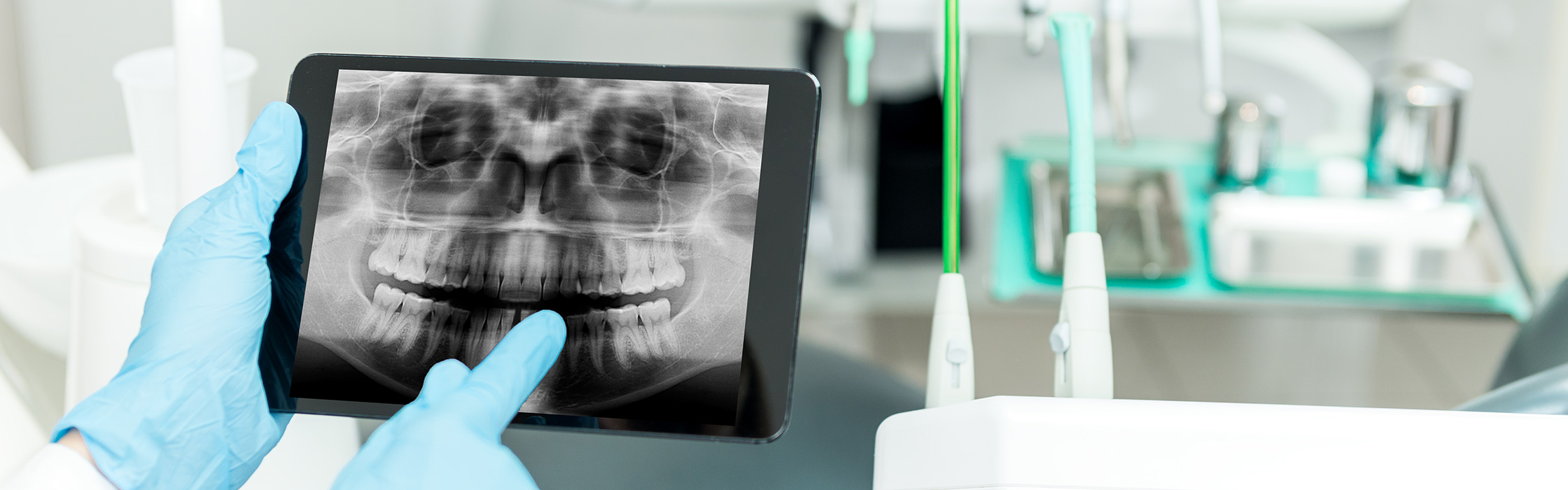 Oralchirurgie: Höchste Präzision in der Zahnmedizin bei komplizierten Eingriffen
