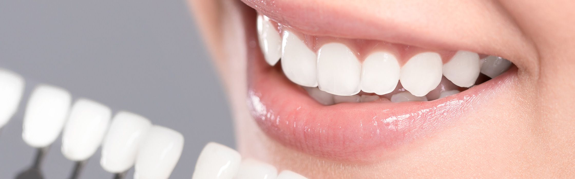 Zahnästhetik: Behandlungen für ästhetische Zähne