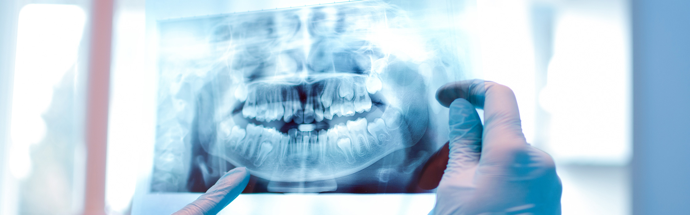 Zahnerhalt – gesunde natürliche Zähne bis ins hohe Alter