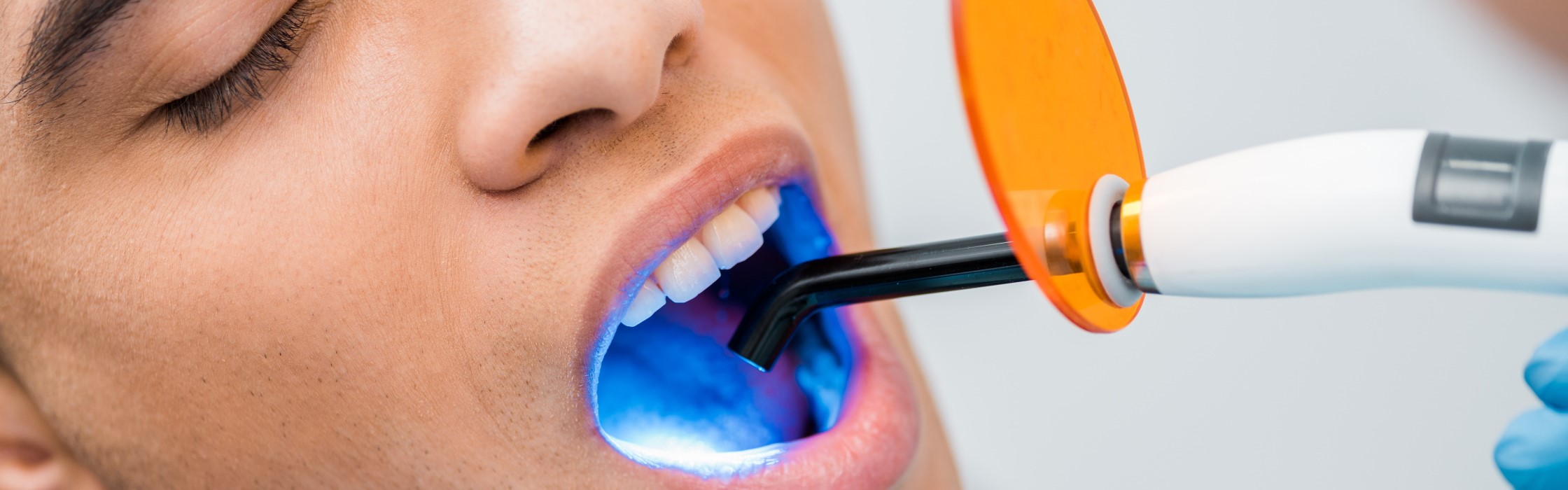 Laserbehandlung beim Zahnarzt: vielfältige Einsatzgebiete