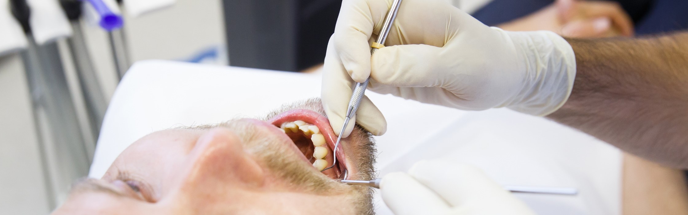 Wurzelbehandlung – Definition, Ablauf und Alternativen zur Therapie des Zahnwurzelkanals