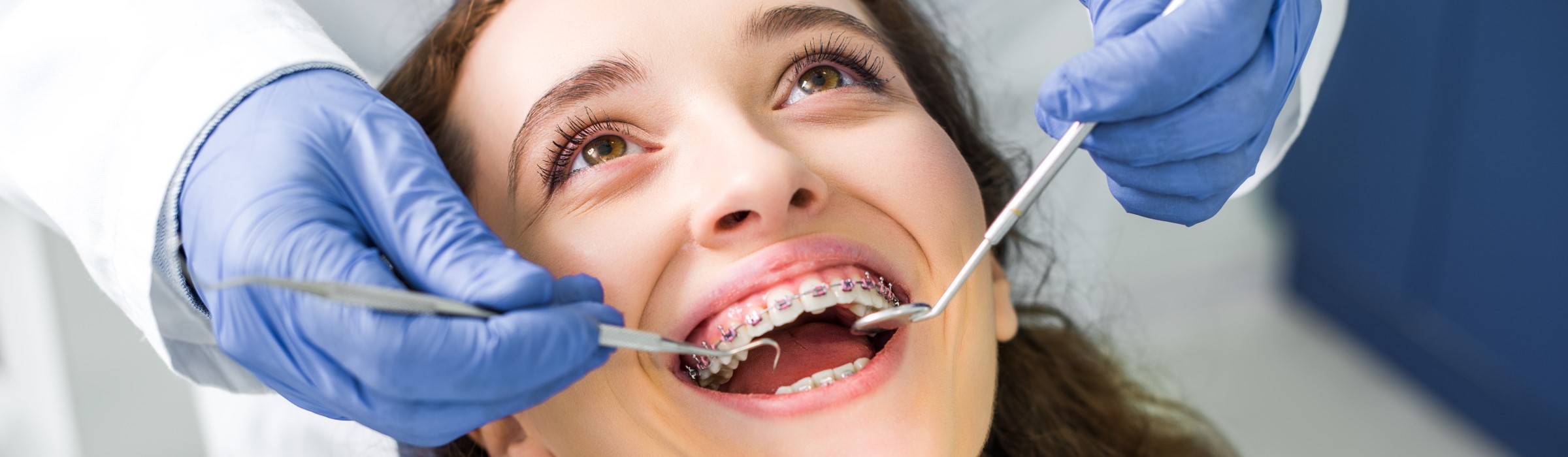 Zahnspange: Wann ist die Behandlung sinnvoll?