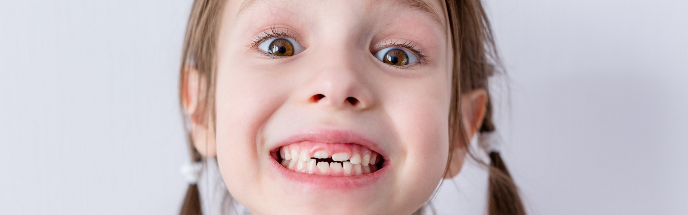 Milchzähne – Wissenswertes über die ersten Zähne