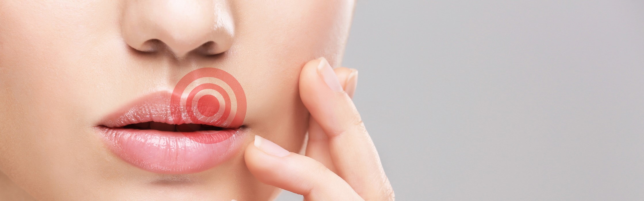 Lippenherpes: Was sind die Symptome und Ursachen?