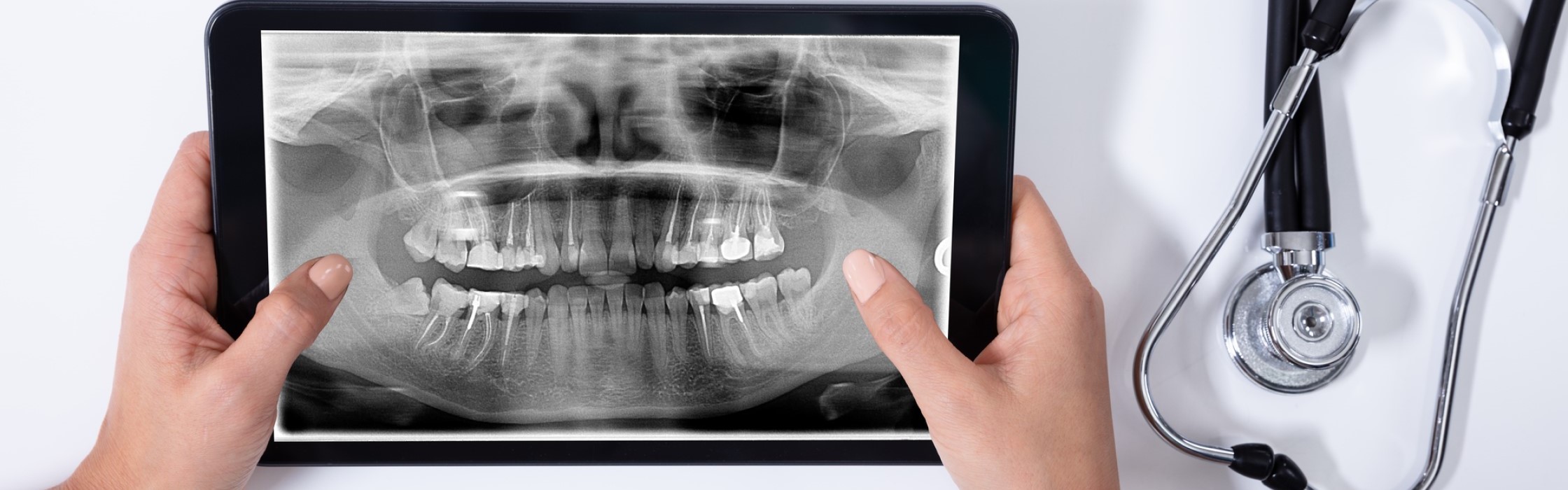 Digitale Zahnmedizin: Die Zukunft der Zahnheilkunde