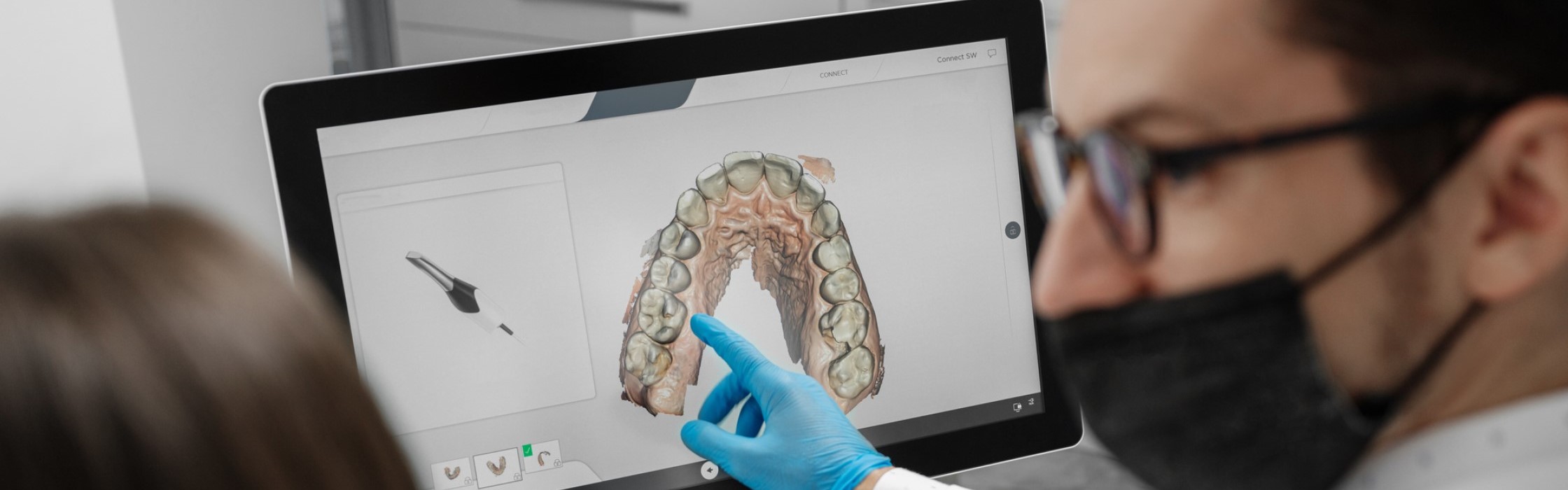 Digitaler Zahnabdruck: für den Patienten angenehmer