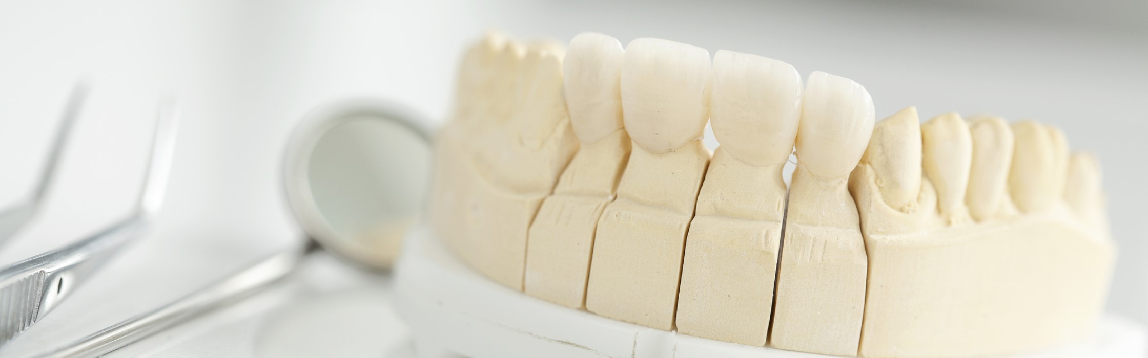 Zirkonkrone: Vorteile und Kosten des Zahnersatzes